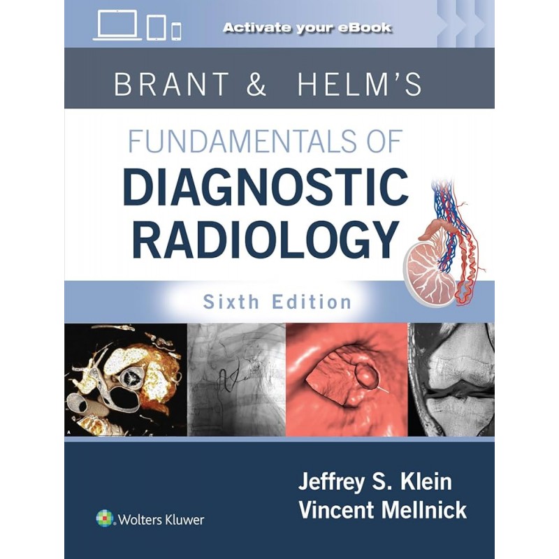 Brant & Helm's Fundamentals of Diagnostic Radiology: Print + eBook with Multimedia  6E