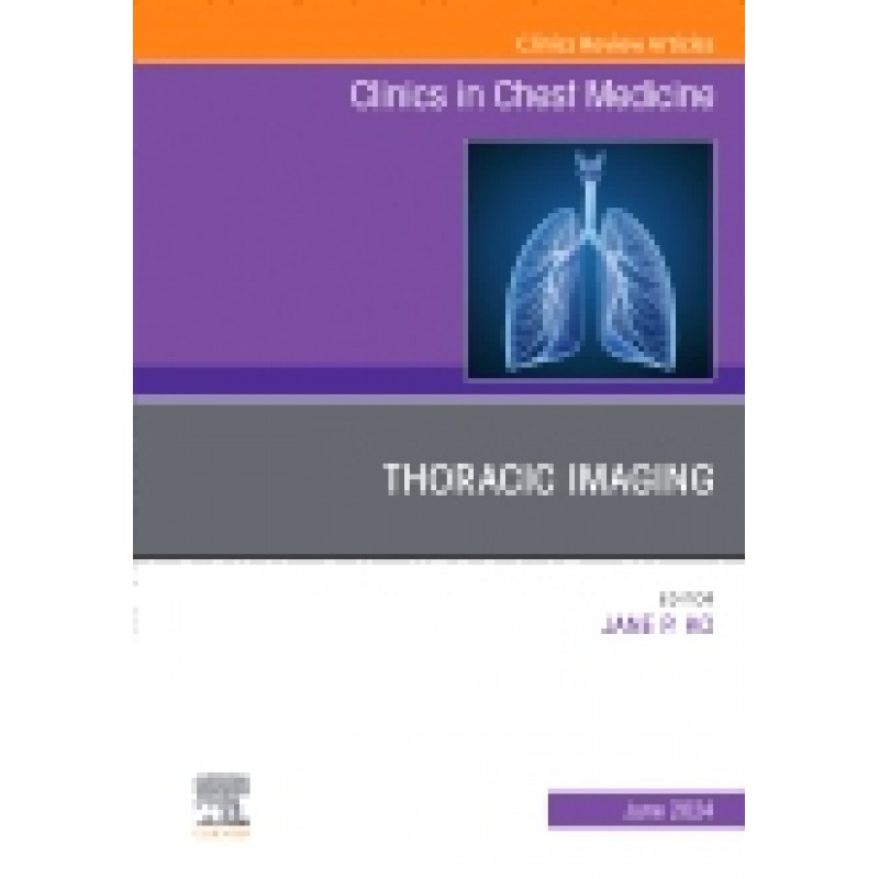 Thoracic Imaging, An Issue of Clinics in Chest Medicine, Volume 45-2