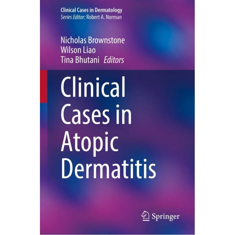 Clinical Cases in Atopic Dermatitis