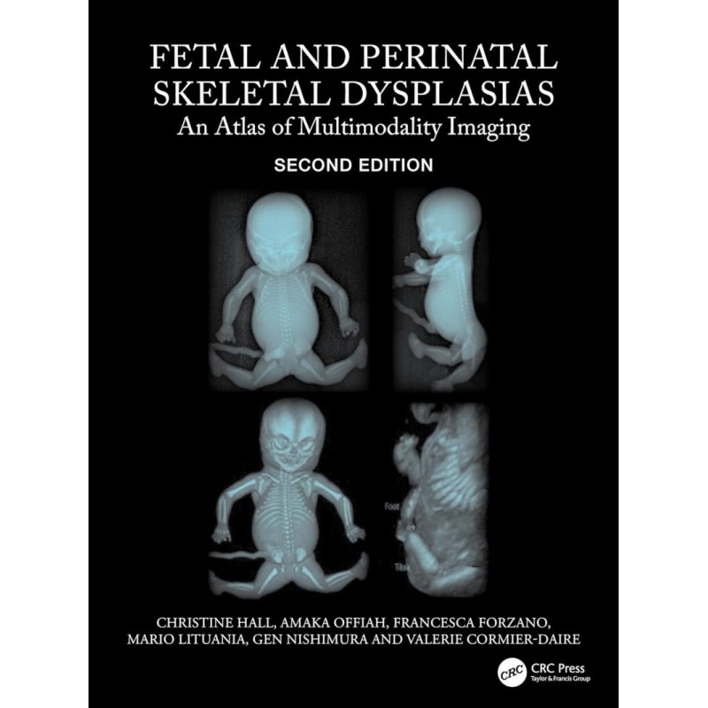 Fetal and Perinatal Skeletal Dysplasias. An Atlas of Multimodality Imaging 2nd Edition