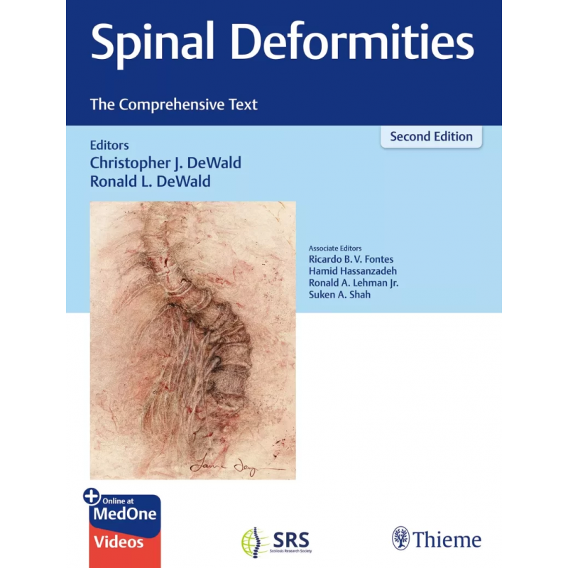 Spinal Deformities. The Comprehensive Text, 2nd Edition