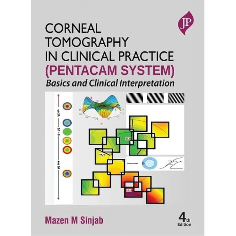 Corneal Tomography in Clinical Practice (Pentacam System): Basics and Clinical Interpretation 4E