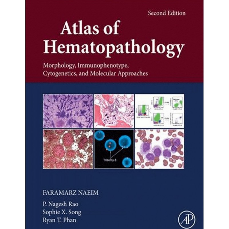 Atlas of Hematopathology 2E: Morphology, Immunophenotype, Cytogenetics, and Molecular Approaches 