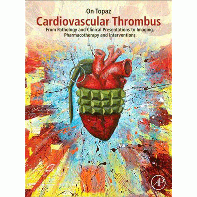 Cardiovascular Thrombus: From Pathology and Clinical Presentations to Imaging, Pharmacotherapy and Interventions