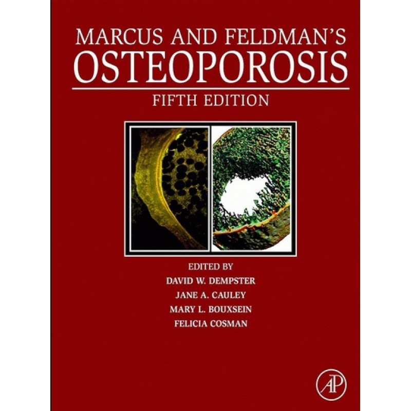 Marcus and Feldman's Osteoporosis 5E