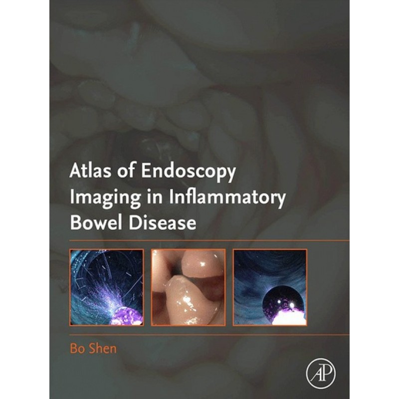 Atlas of Endoscopy Imaging in Inflammatory Bowel Disease