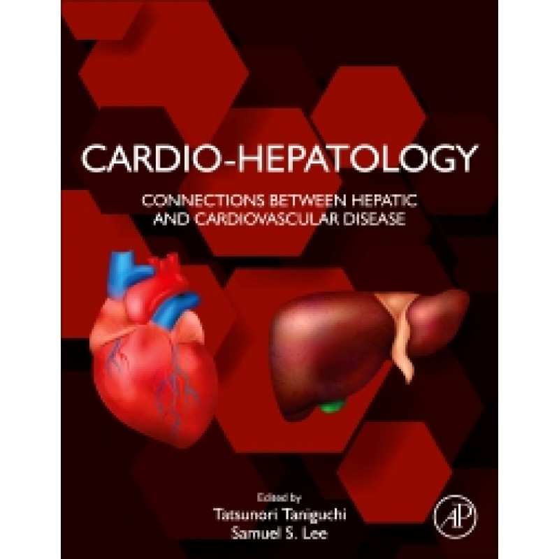 Cardio-Hepatology Connections Between Hepatic and Cardiovascular Disease