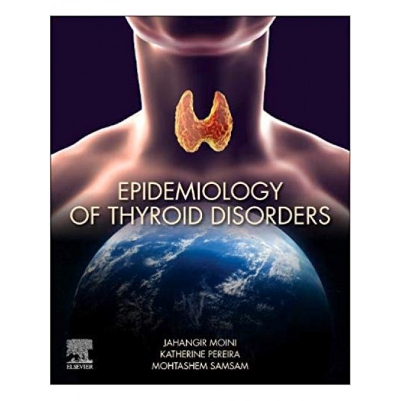 Epidemiology of Thyroid Disorders