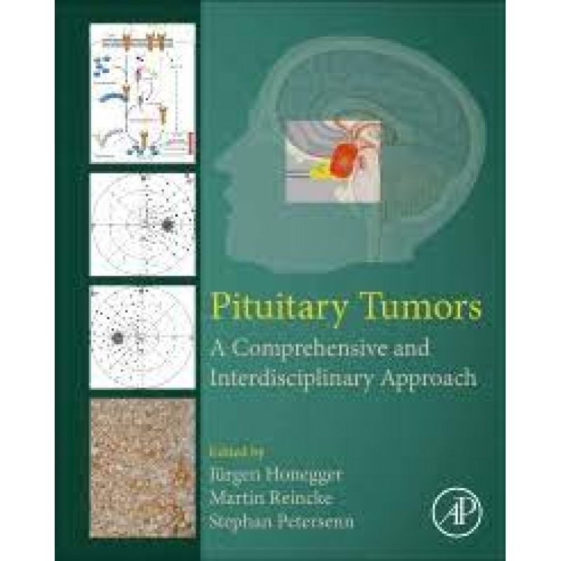 Pituitary Tumors A Comprehensive and Interdisciplinary Approach