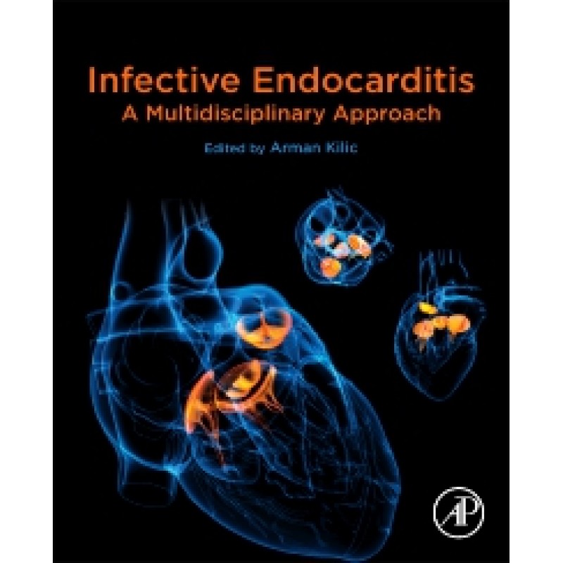 Infective Endocarditis