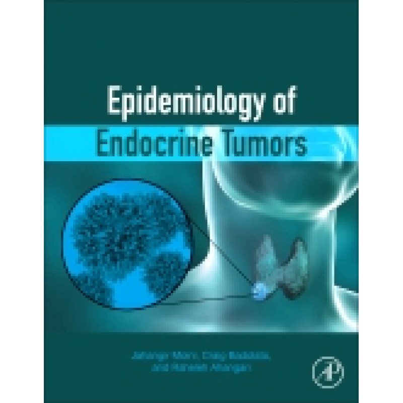 Epidemiology of Endocrine Tumors