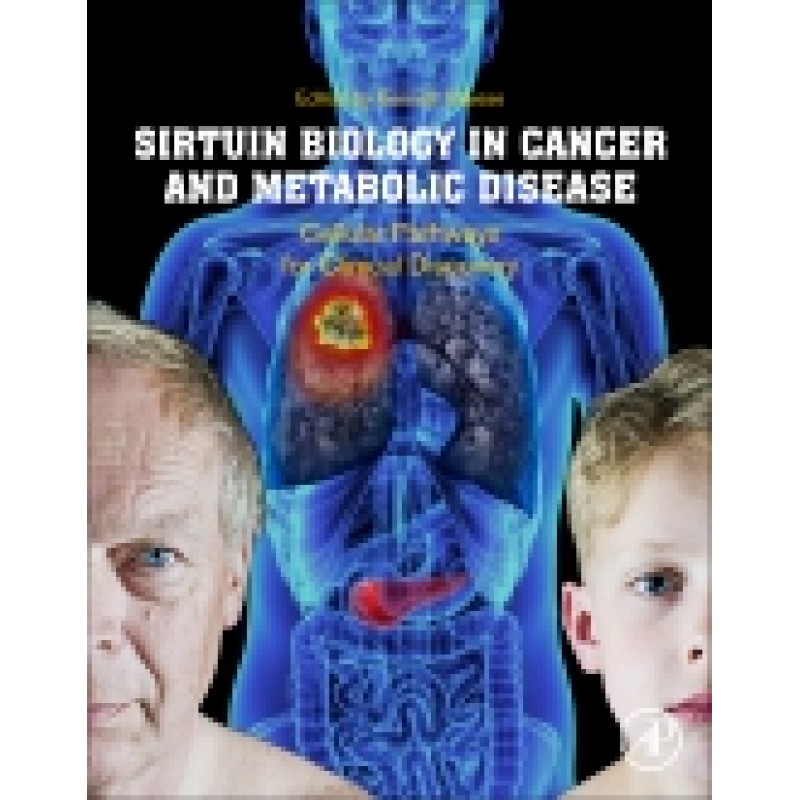 Sirtuin Biology in Cancer and Metabolic Disease, Cellular Pathways for Clinical Discovery