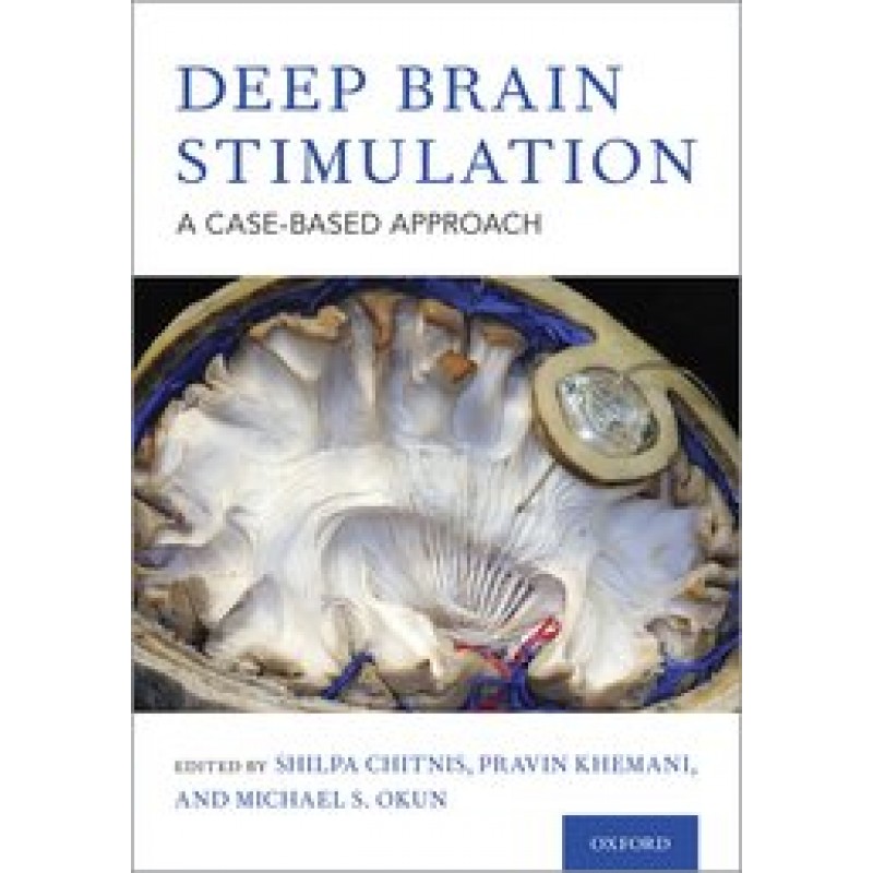 Deep Brain Stimulation: A Case-based Approach