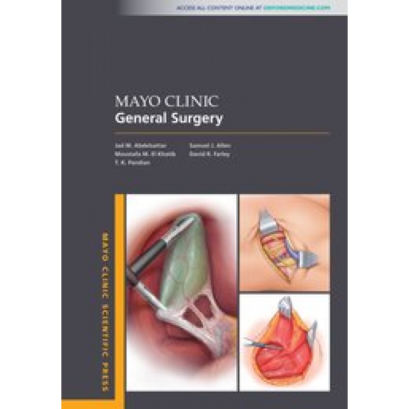 Mayo Clinic General Surgery