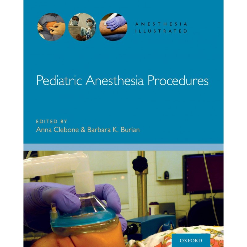 Pediatric Anesthesia Procedures