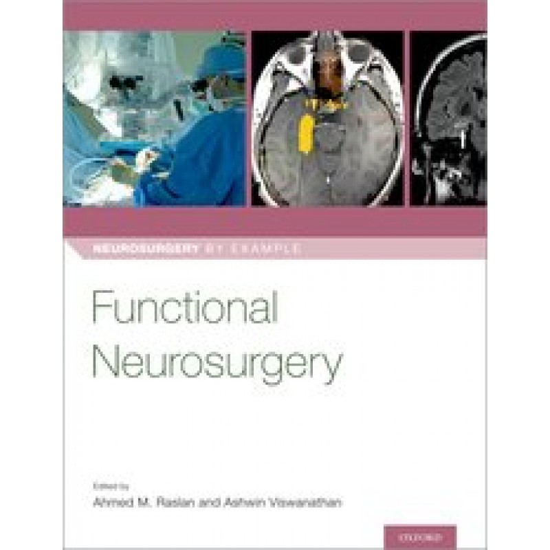 Functional Neurosurgery