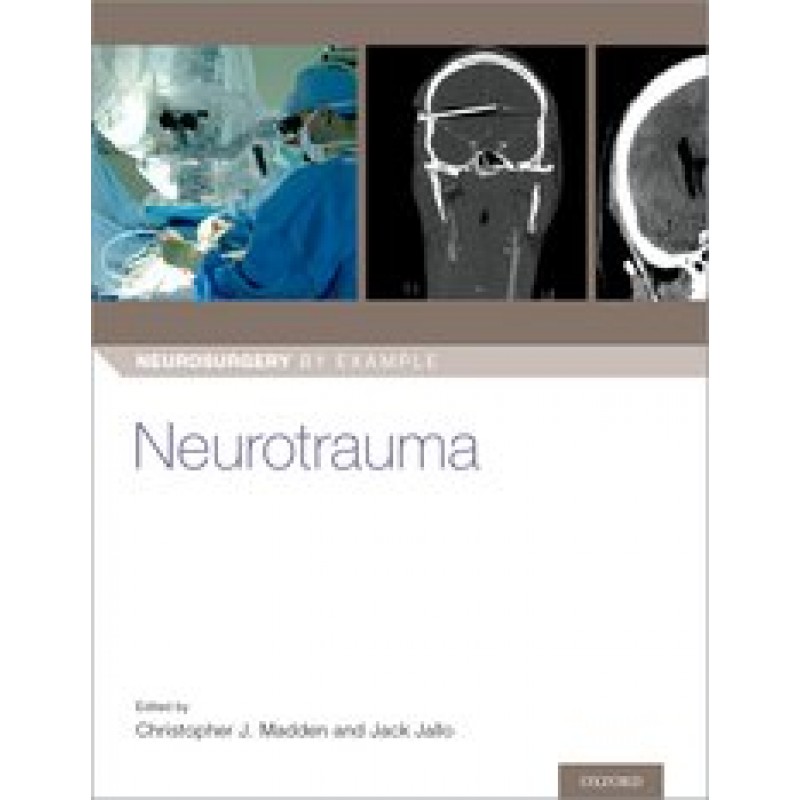 Neurotrauma