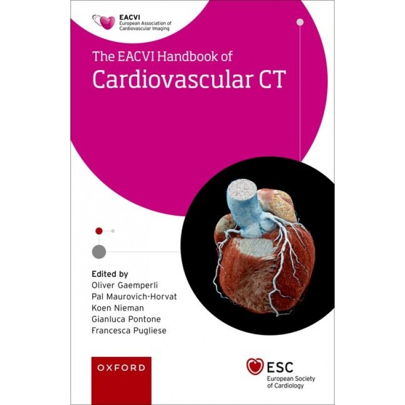 EACVI Handbook of Cardiovascular CT