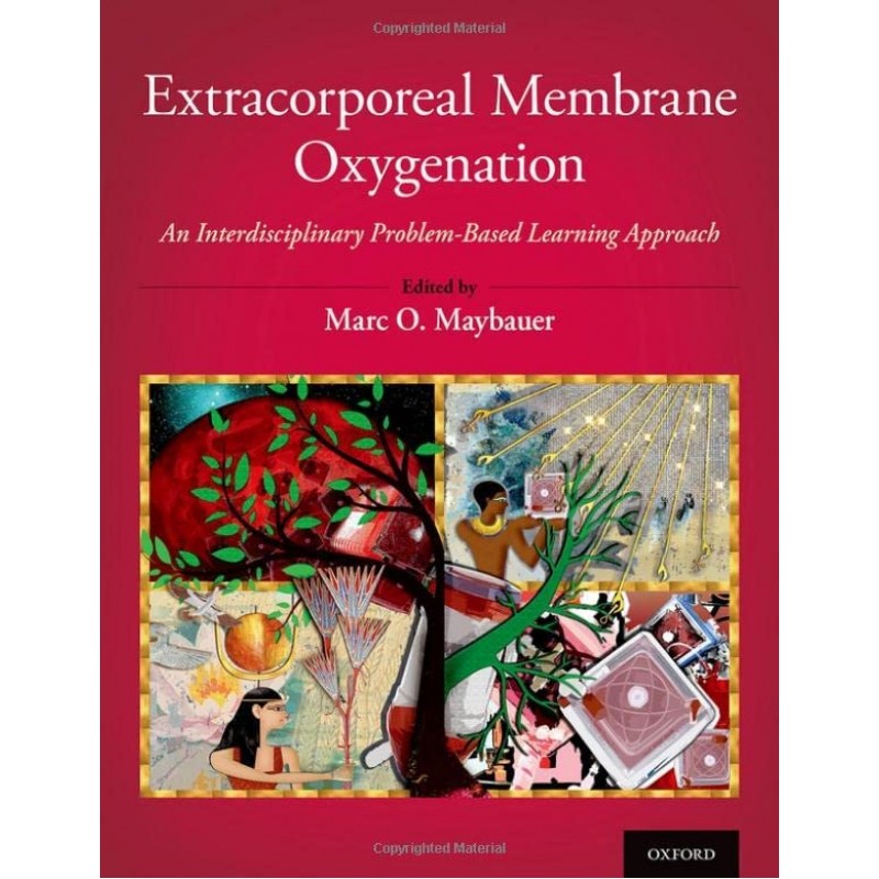 Extracorporeal Membrane Oxygenation