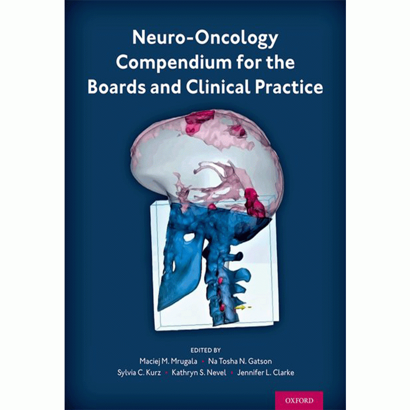 Neuro-Oncology Compendium for the Boards and Clinical Practice