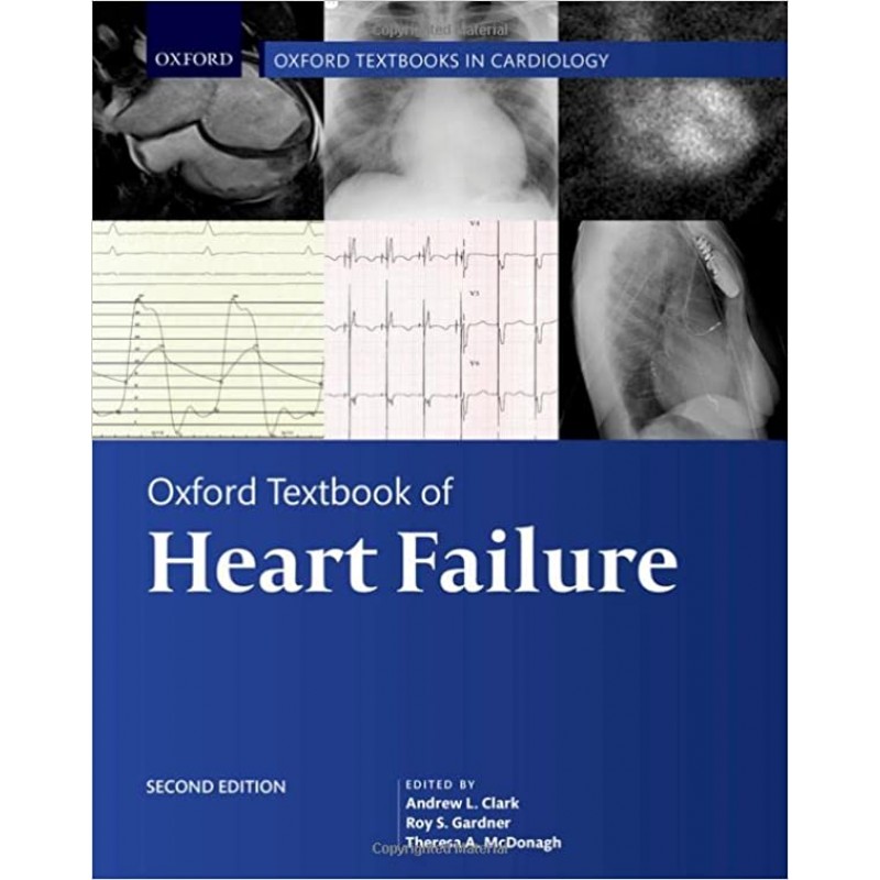 Oxford Textbook of Heart Failure, 2E