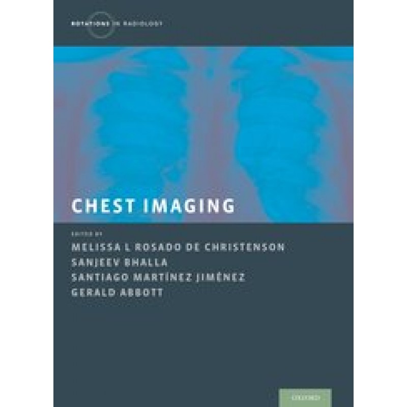 Chest Imaging