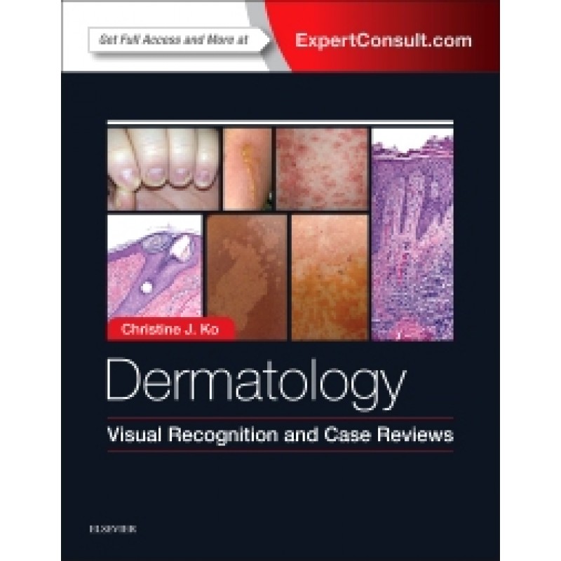 Dermatology: Visual Recognition and Case Reviews