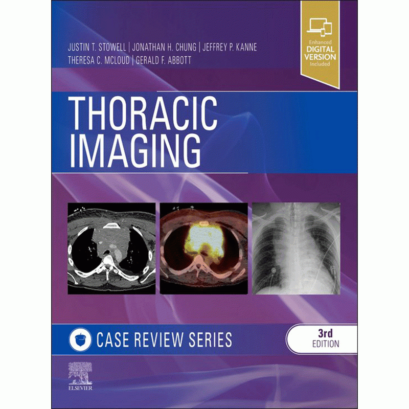 Thoracic Imaging: Case Review, 3rd Edition