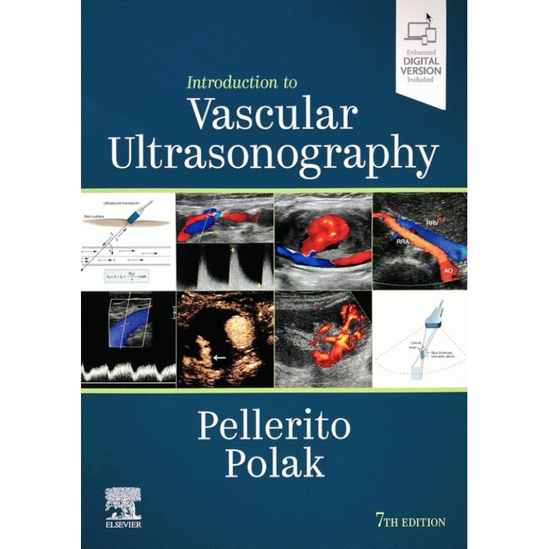 Introduction to Vascular Ultrasonography 7E