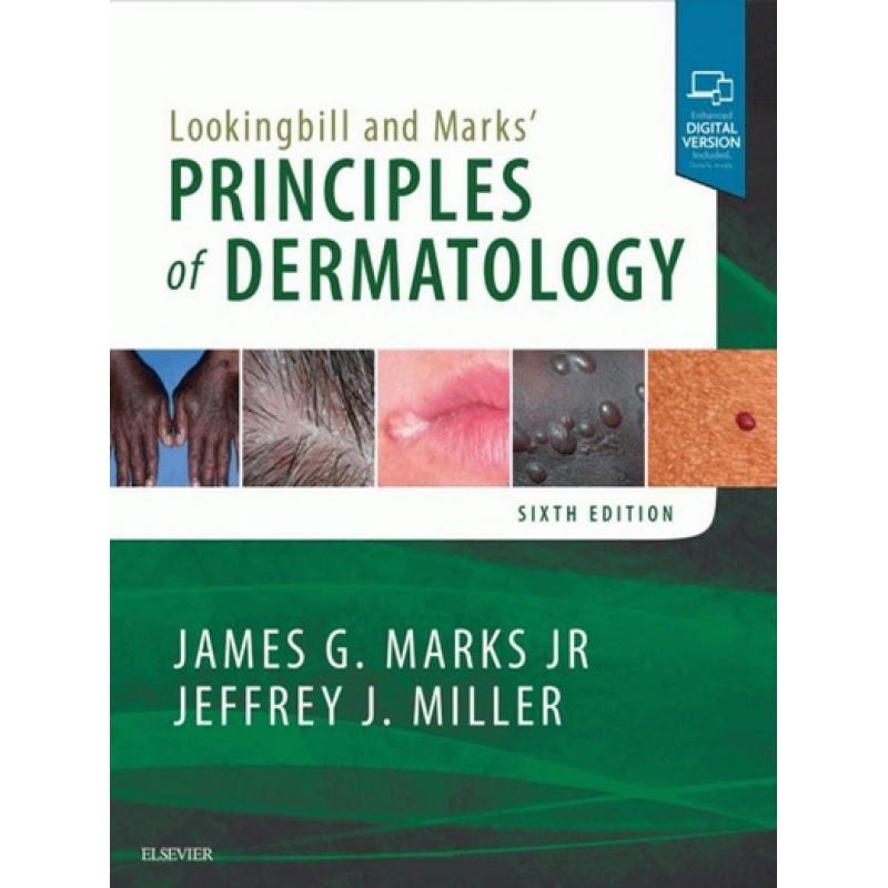 Lookingbill and Marks' Principles of Dermatology 6th Edition