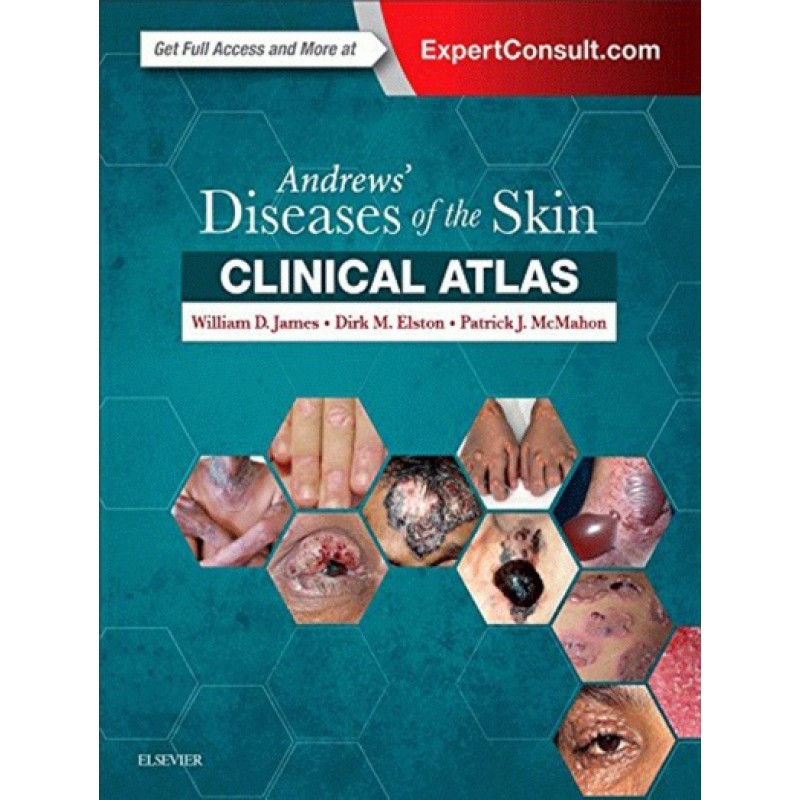 Andrews' Diseases of the Skin Clinical Atlas, James