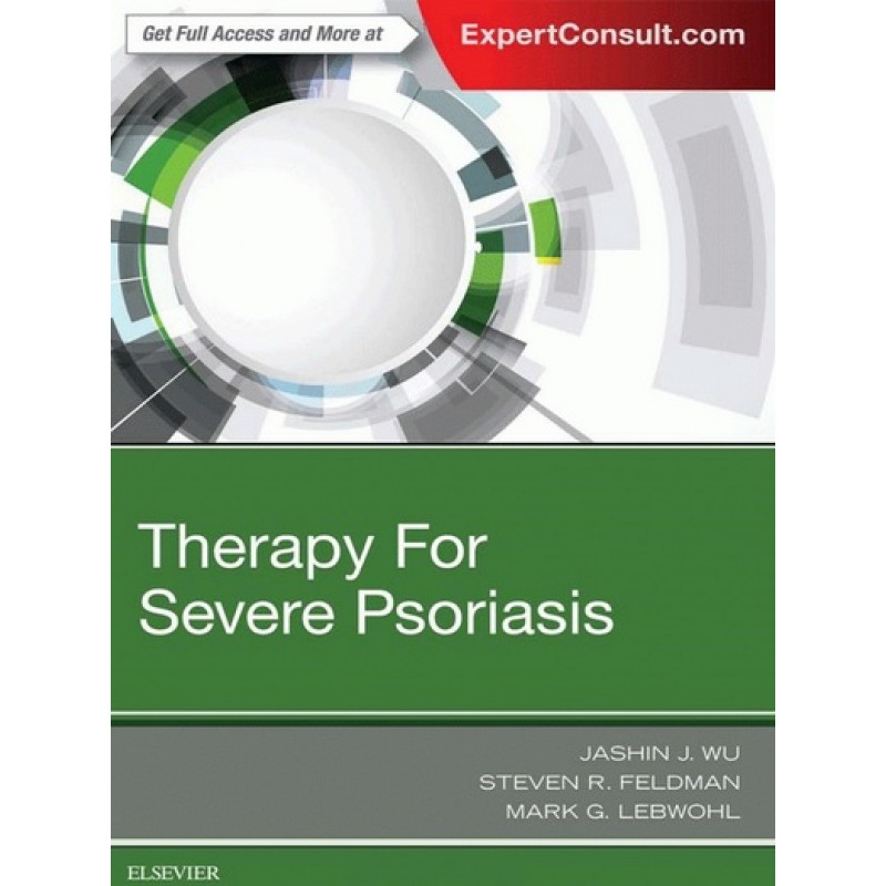 Therapy for Severe Psoriasis