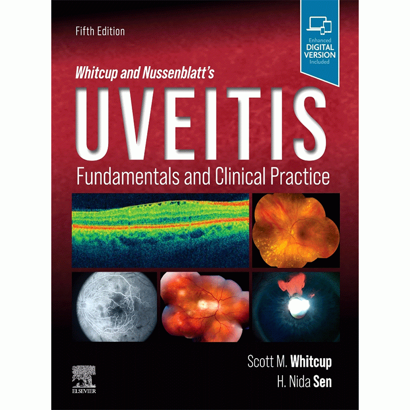 Whitcup and Nussenblatt’s Uveitis: Fundamentals and Clinical Practice, 5E