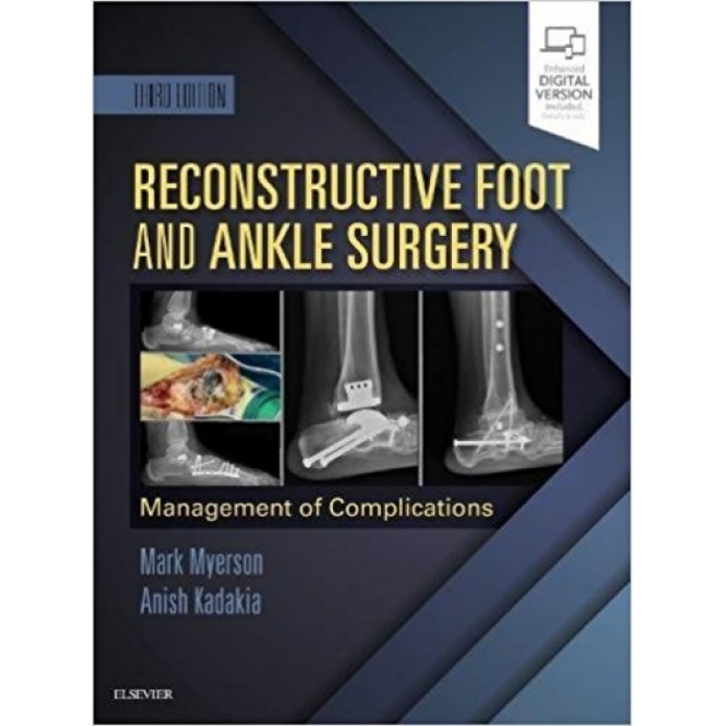 Reconstructive Foot and Ankle Surgery: Management of Complications , 3E