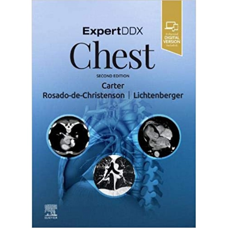 ExpertDDx: Chest, 2nd Edition