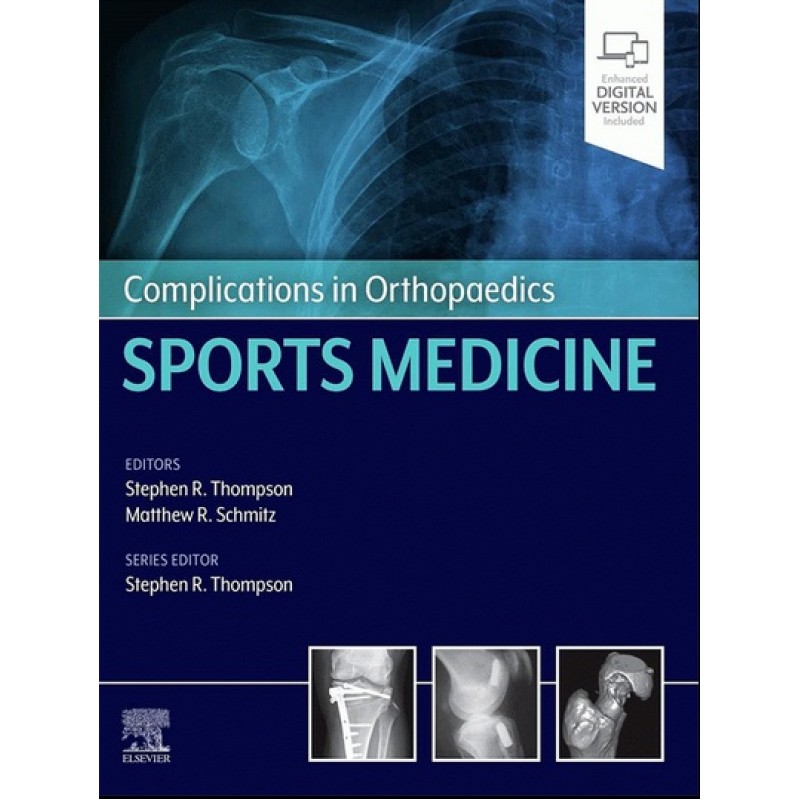 Complications in Orthopaedics: Sports Medicine