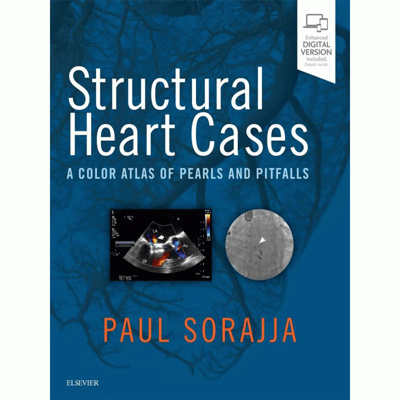 Structural Heart Cases: A Color Atlas of Pearls and Pitfalls