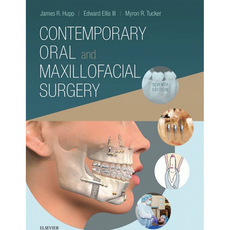 Contemporary Oral and Maxillofacial Surgery, 7th Edition