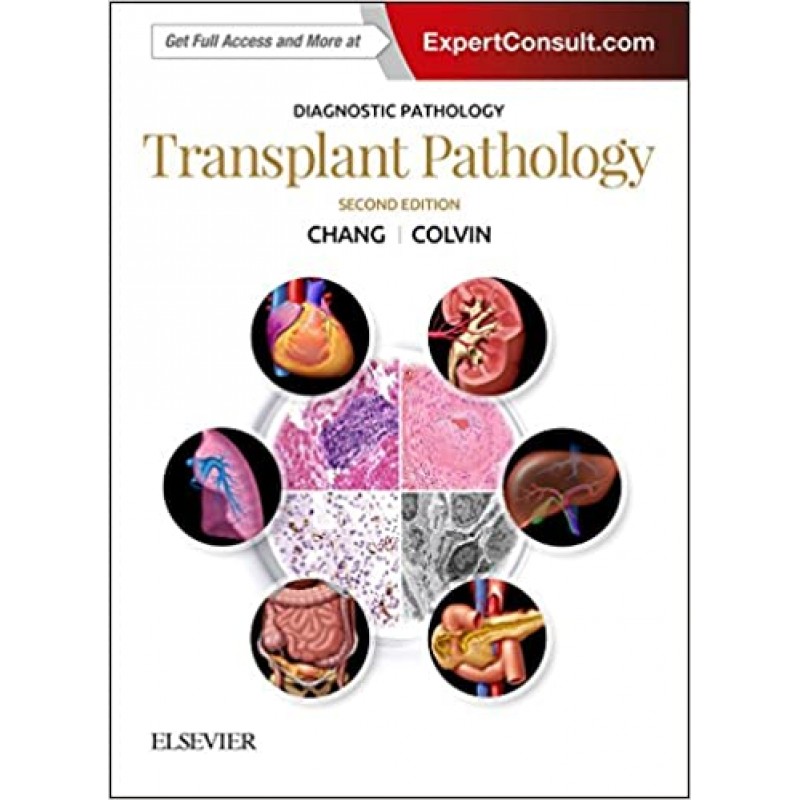 Diagnostic Pathology: Transplant Pathology, 2nd Edition