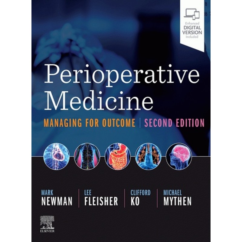 Perioperative Medicine 2E: Managing for Outcome