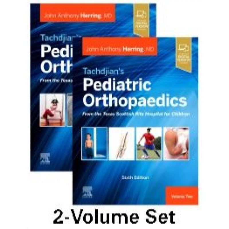 Tachdjian's Pediatric Orthopaedics: From the Texas Scottish Rite Hospital for Children 6E