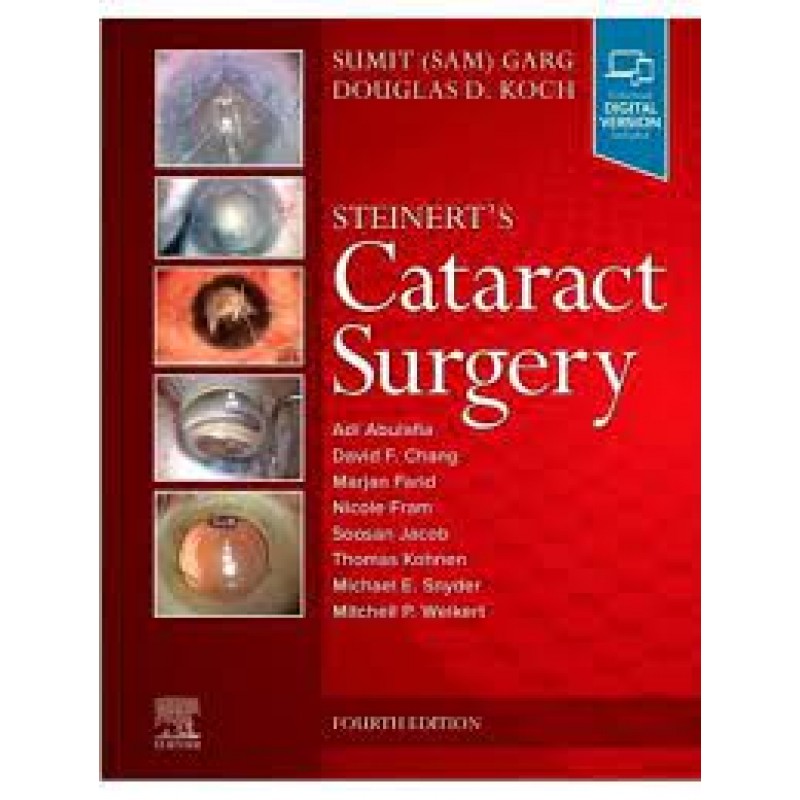 Steinert's Cataract Surgery, 4E 