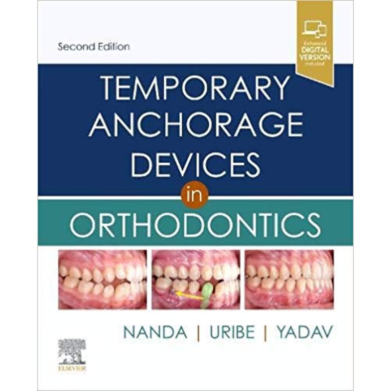 Temporary Anchorage Devices in Orthodontics, 2nd Edition