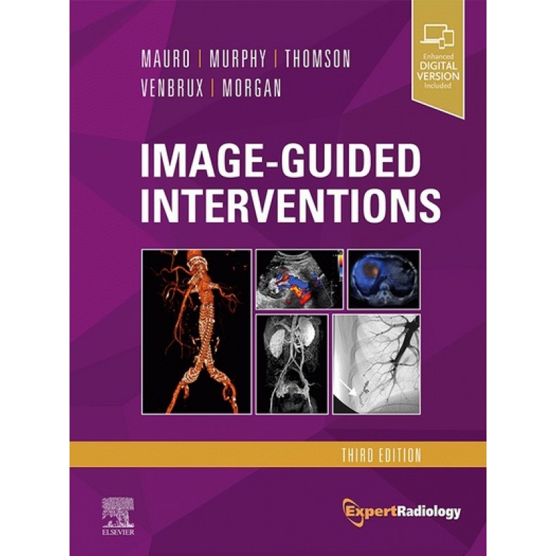 Image-Guided Interventions 3E: Expert Radiology Series