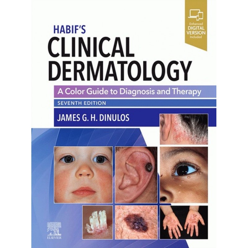 Habif’s Clinical Dermatology: A Color Guide to Diagnosis and Therapy 7E