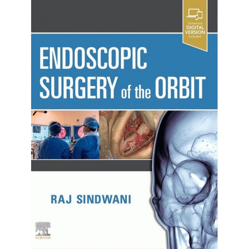 Endoscopic Surgery of the Orbit