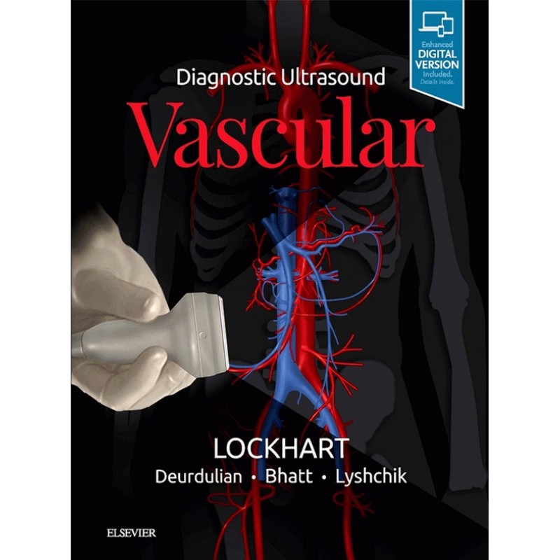 Diagnostic Ultrasound: Vascular