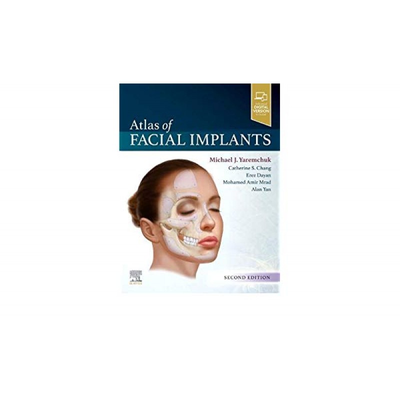 Atlas of Facial Implants, 2nd Edition