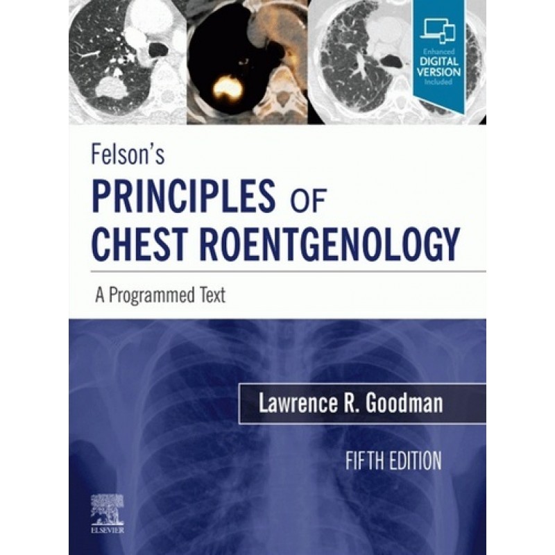 Felson's Principles of Chest Roentgenology: A Programmed Text 5E