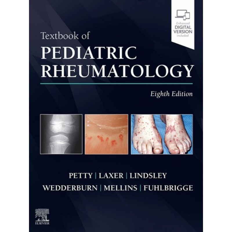 Textbook of Pediatric Rheumatology, 8E